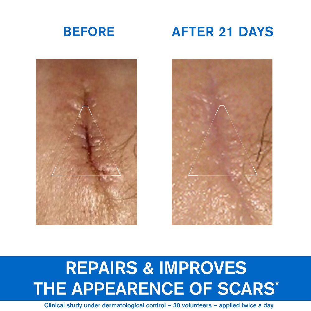 Uriage Bariéderm Repairing Cica-Cream