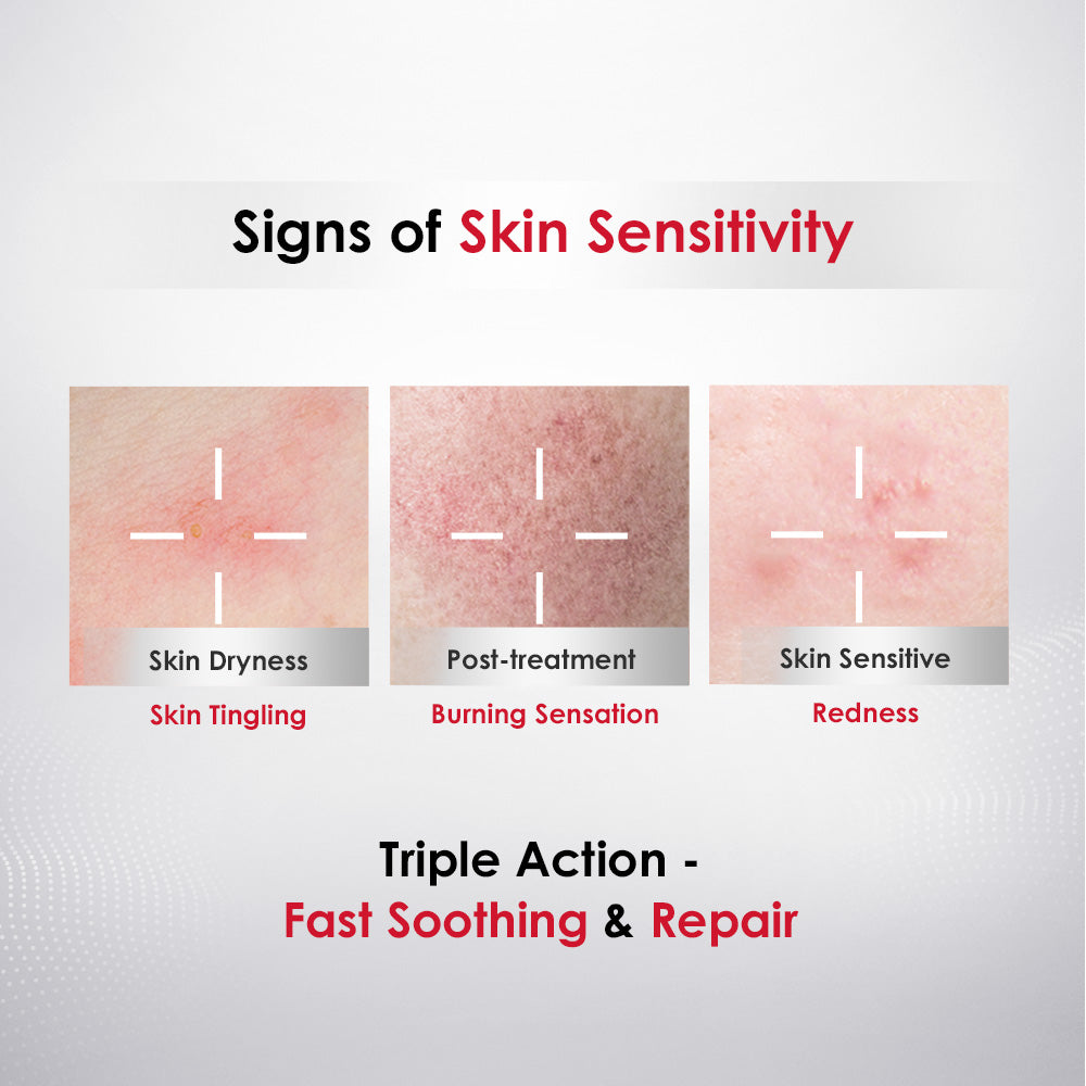 Winona Sensitiveness Relieving Moisturizing And Smoothing Mask 6s