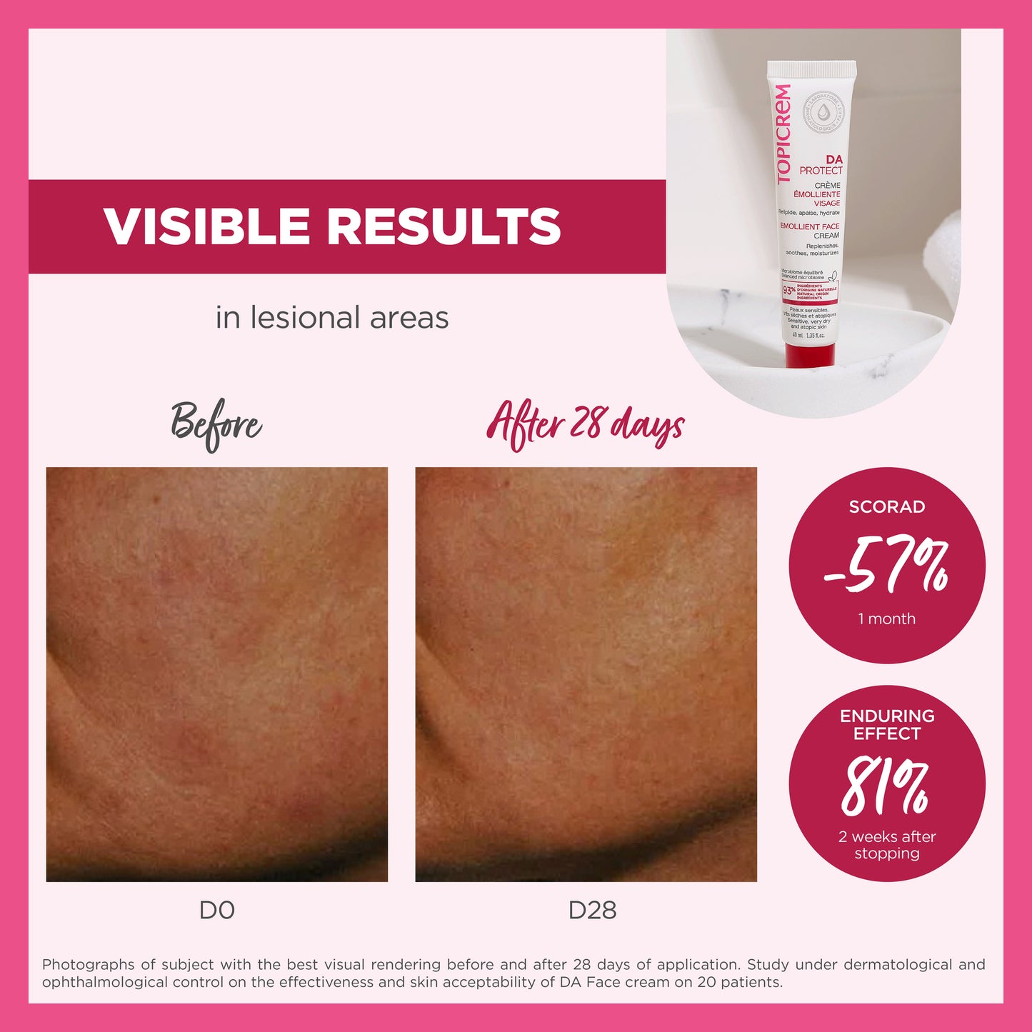 Topicrem DA PROTECT Emollient Face Cream 40ml