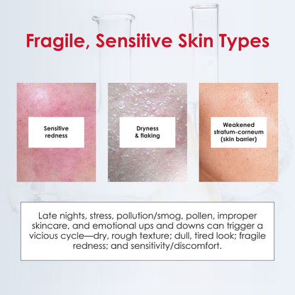 Winona Barrier Repairing Essence 30ml