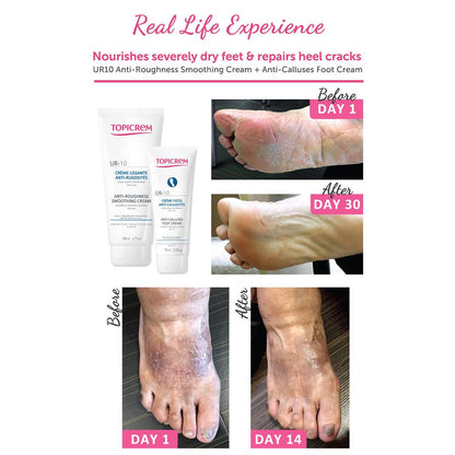 Topicrem DERMO SPECIFIC UR10 Anti-Calluses Foot Cream 75ml