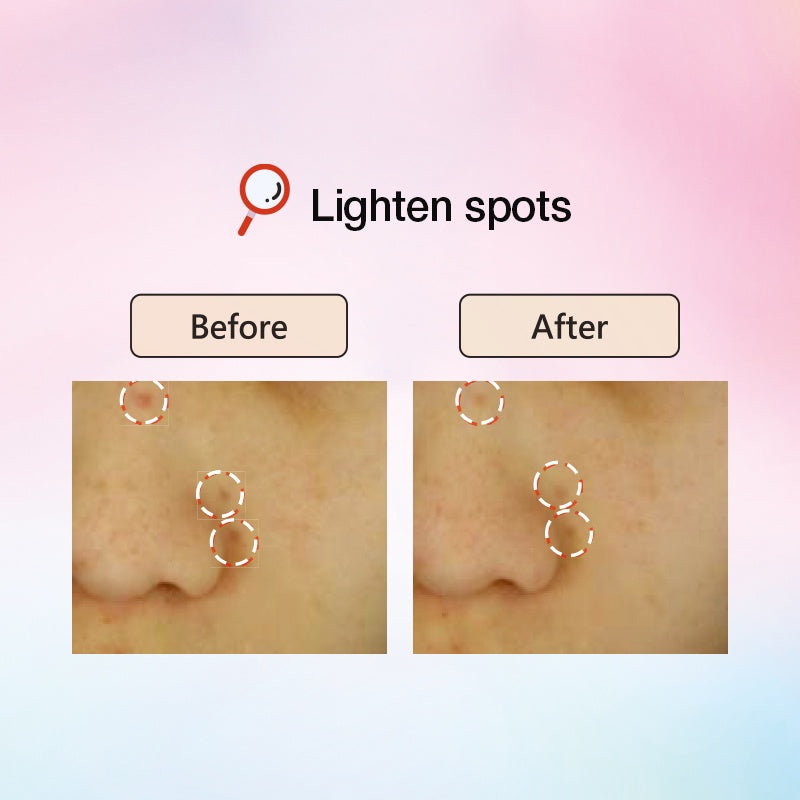 Neogence Brightening Spot Corrector 30ml